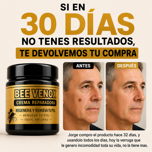 Elimina verrugas y papilomas desde casa, sin dolor y sin que vuelvan