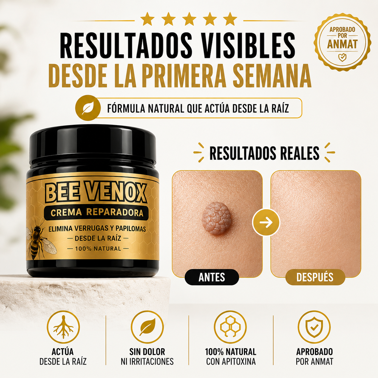 Elimina verrugas y papilomas desde casa, sin dolor y sin que vuelvan