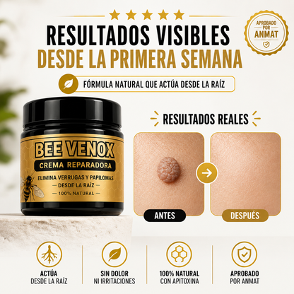 Elimina verrugas y papilomas desde casa, sin dolor y sin que vuelvan