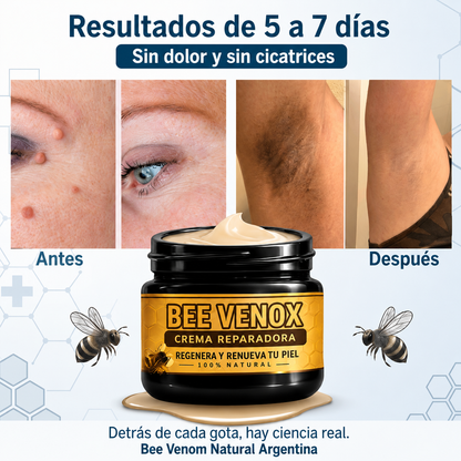 Elimina verrugas y papilomas desde casa, sin dolor y sin que vuelvan